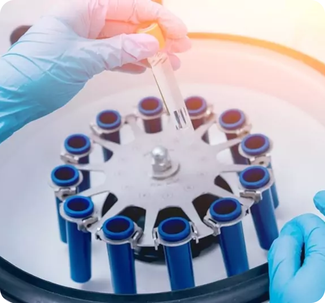 prf à Garches Dr Luna Maeva