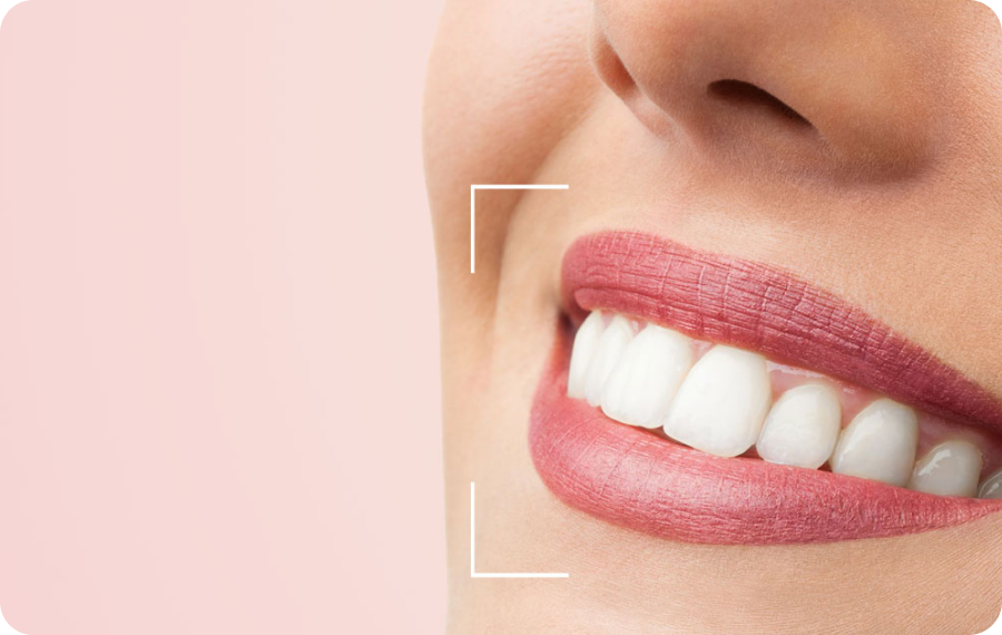 Éclaircissement dentaire