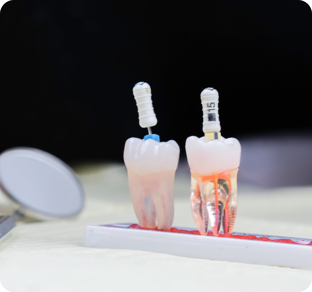 digue à Garches Dr Luna Maeva