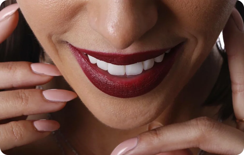 Éclaircissement dentaire