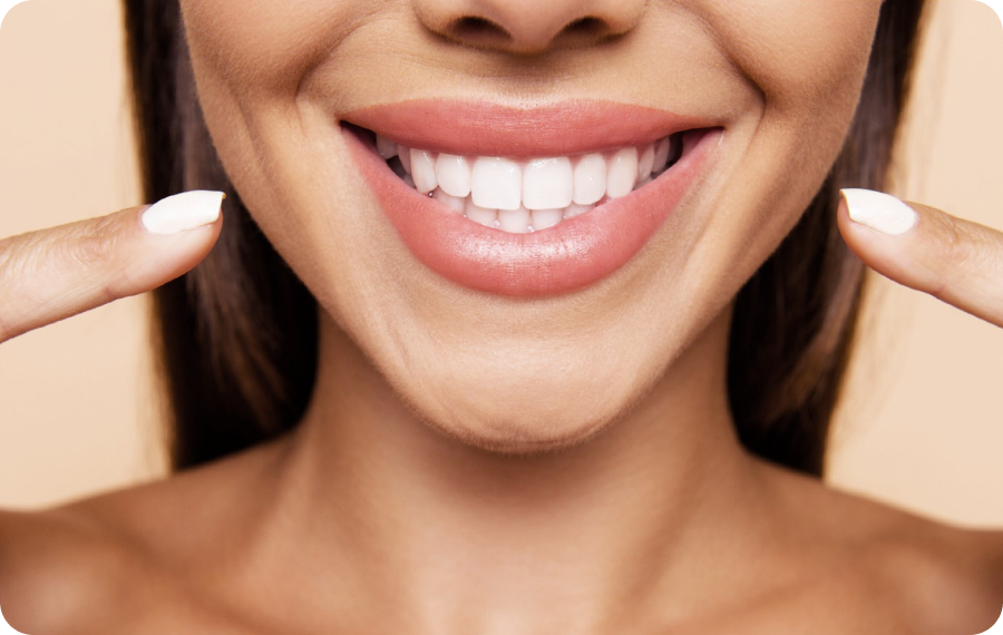 Éclaircissement dentaire