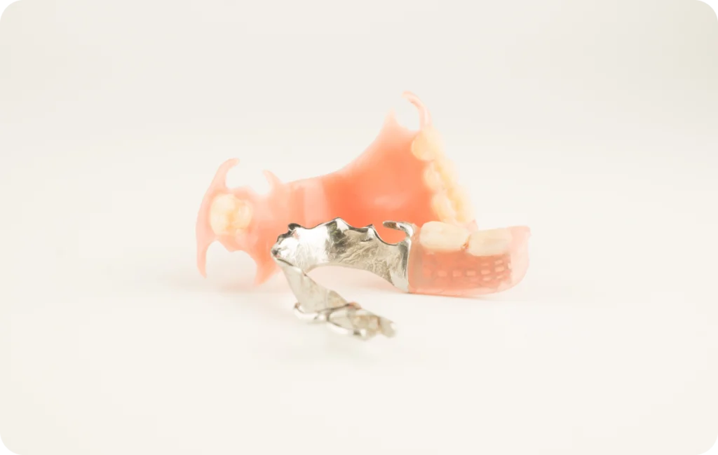 Prothèse implanto portée