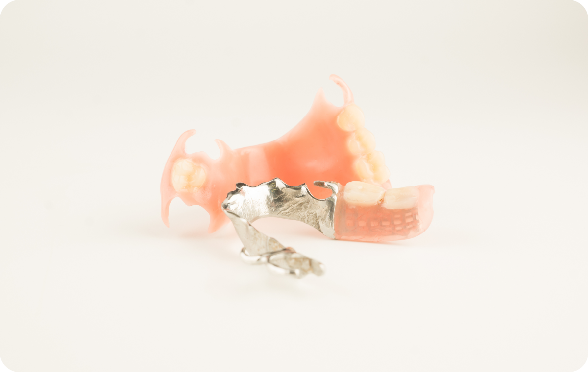 Prothèse dento portée